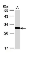 Anti-FRAT1 antibody [C2C3], C-term used in Western Blot (WB). GTX110492