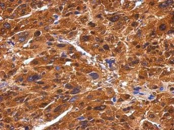 Anti-BIVM antibody [C3], C-term used in IHC (Paraffin sections) (IHC-P). GTX110496