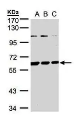 Anti-BIVM antibody [C3], C-term used in Western Blot (WB). GTX110496