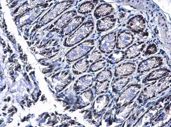 Anti-PIASy antibody used in IHC (Paraffin sections) (IHC-P). GTX110497