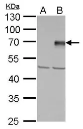 Anti-PIASy antibody used in Western Blot (WB). GTX110497
