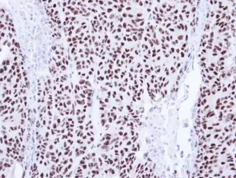 Anti-PIASy antibody used in IHC (Paraffin sections) (IHC-P). GTX110497
