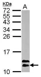 Anti-RBX1 antibody used in Western Blot (WB). GTX110507