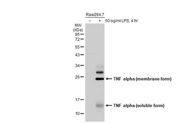Anti-TNF alpha antibody used in Western Blot (WB). GTX110520