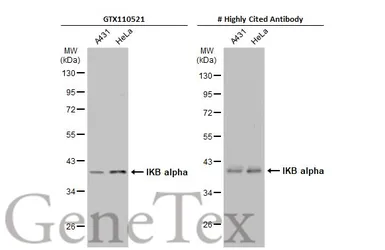 Anti-IKB alpha antibody used in Western Blot (WB). GTX110521