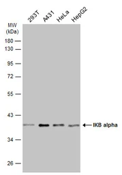 Anti-IKB alpha antibody used in Western Blot (WB). GTX110521