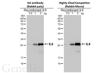 Anti-IL6 antibody used in Western Blot (WB). GTX110527