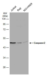 Anti-Caspase 2 antibody used in Western Blot (WB). GTX110542