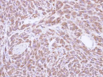 Anti-PCMT1 antibody used in IHC (Paraffin sections) (IHC-P). GTX110556