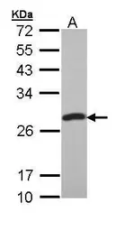 Anti-PCMT1 antibody used in Western Blot (WB). GTX110556