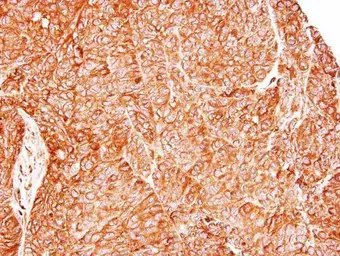 Anti-TC21 antibody [N1C3] used in IHC (Paraffin sections) (IHC-P). GTX110559