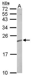 Anti-TC21 antibody [N1C3] used in Western Blot (WB). GTX110559