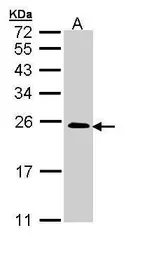 Anti-TC21 antibody [N1C3] used in Western Blot (WB). GTX110559