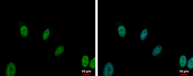 Anti-ERCC1 antibody [N1C3] used in Immunocytochemistry/ Immunofluorescence (ICC/IF). GTX110562