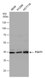 Anti-PSAT1 antibody [N1C3] used in Western Blot (WB). GTX110576