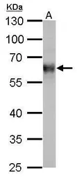 Anti-TrxR1 antibody used in Western Blot (WB). GTX110589
