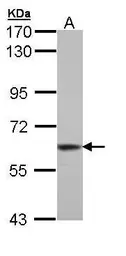 Anti-TrxR1 antibody used in Western Blot (WB). GTX110589