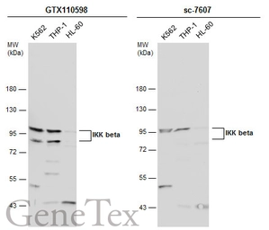 Anti-IKK beta antibody used in Western Blot (WB). GTX110598