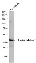 Anti-Citrate synthase antibody [N2C3] used in Western Blot (WB). GTX110624