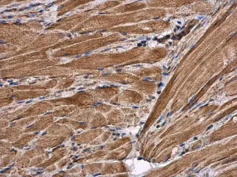 Anti-Citrate synthase antibody [N2C3] used in IHC (Paraffin sections) (IHC-P). GTX110624