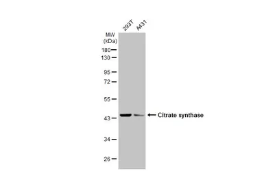 Anti-Citrate synthase antibody [N2C3] used in Western Blot (WB). GTX110624