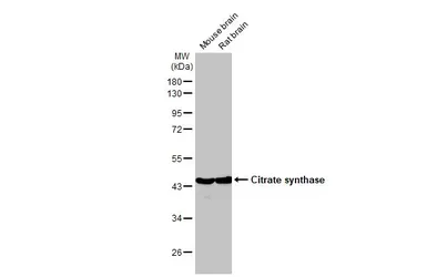 Anti-Citrate synthase antibody [N2C3] used in Western Blot (WB). GTX110624