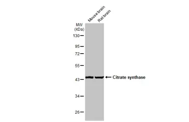 Anti-Citrate synthase antibody [N2C3] used in Western Blot (WB). GTX110624