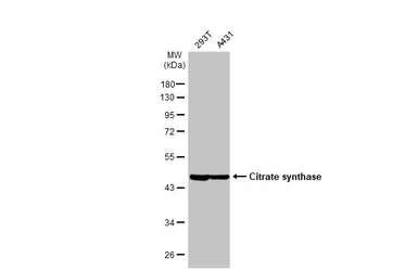 Anti-Citrate synthase antibody [N2C3] used in Western Blot (WB). GTX110624