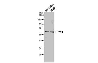 Anti-YY1 antibody used in Western Blot (WB). GTX110625