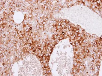 Anti-RBP4 antibody used in IHC (Paraffin sections) (IHC-P). GTX110632
