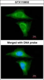 Anti-RBP4 antibody used in Immunocytochemistry/ Immunofluorescence (ICC/IF). GTX110632