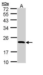 Anti-RBP4 antibody used in Western Blot (WB). GTX110632