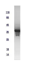 Human HAT1 protein, His tag. GTX110643-pro