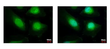 Anti-HAT1 antibody used in Immunocytochemistry/ Immunofluorescence (ICC/IF). GTX110643
