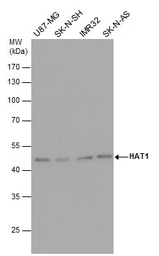 Anti-HAT1 antibody used in Western Blot (WB). GTX110643