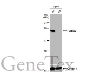 Anti-RAB6A antibody used in Western Blot (WB). GTX110646