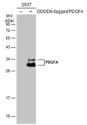 Anti-PDGFA antibody used in Western Blot (WB). GTX110647