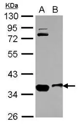 Anti-OSTM1 antibody [N1C3] used in Western Blot (WB). GTX110670