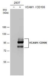 Anti-VCAM1 / CD106 antibody [N1N2], N-term used in Western Blot (WB). GTX110684