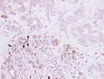 Anti-VCAM1 / CD106 antibody [N1N2], N-term used in IHC (Paraffin sections) (IHC-P). GTX110684