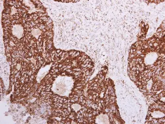 Anti-SLC25A22 antibody [N1C3] used in IHC (Paraffin sections) (IHC-P). GTX110700