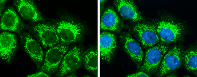 Anti-SLC25A22 antibody [N1C3] used in Immunocytochemistry/ Immunofluorescence (ICC/IF). GTX110700