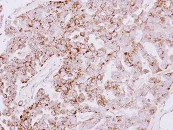 Anti-SLC25A22 antibody [N1C3] used in IHC (Paraffin sections) (IHC-P). GTX110700