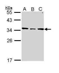 Anti-SLC25A22 antibody [N1C3] used in Western Blot (WB). GTX110700