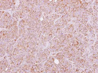 Anti-HTRA2 antibody used in IHC (Paraffin sections) (IHC-P). GTX110703
