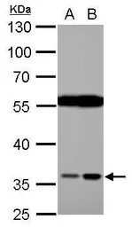 Anti-HTRA2 antibody used in Western Blot (WB). GTX110703