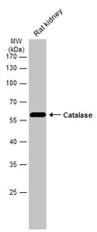 Anti-Catalase antibody used in Western Blot (WB). GTX110704