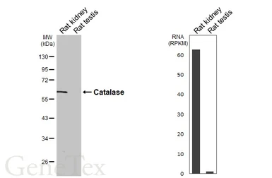 Anti-Catalase antibody used in Western Blot (WB). GTX110704