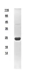 Human DHFR protein, His tag. GTX110710-pro