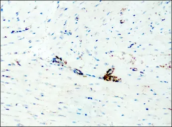 Anti-Destrin antibody used in IHC (Paraffin sections) (IHC-P). GTX11072